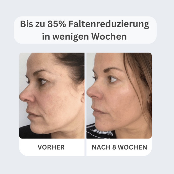 Natural Botulinum Serum